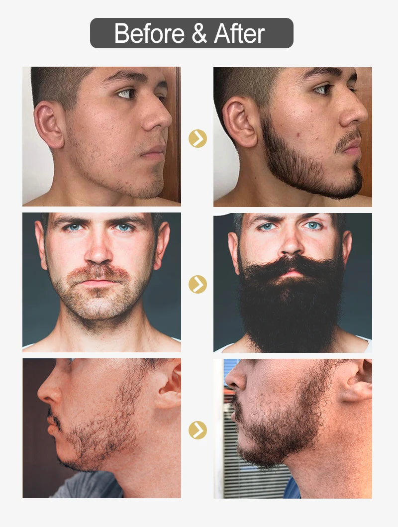 PURC Beard Growth Oil for Men – Nourishing & Soften Beard Grooming Treatment